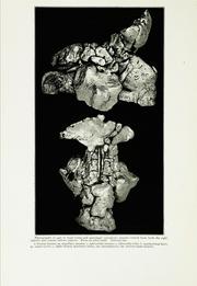 Cover of: The nose, paranasal sinuses, nasolacrimal passageways, and olfactory organ in man by J. Parsons Schaeffer, J. Parsons Schaeffer