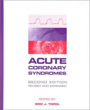 Cover of: Acute Coronary Syndromes by Eric J. Topol