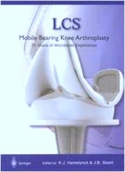 Cover of: LCS mobile bearing knee arthroplasty: a 25 years worldwide review