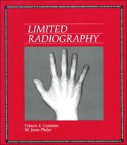 Cover of: Limited radiography by Frances Campeau