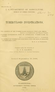 Tuberculosis investigations