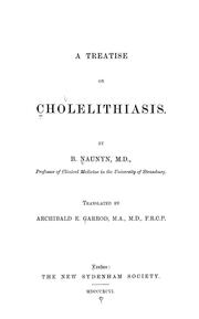 Cover of: A treatise on cholelithiasis