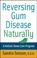 Cover of: Reversing Gum Disease Naturally