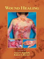 Cover of: Wound Healing by 