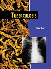 Cover of: Tuberculosis by 