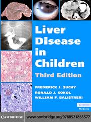 Cover of: Liver Disease in Children
