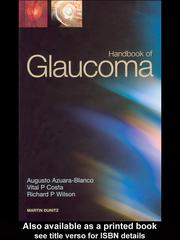 Cover of: Handbook of Glaucoma