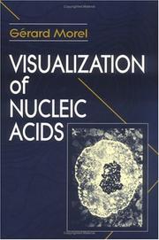 Cover of: Visualization of nucleic acids