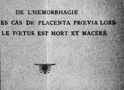 Cover of: De l'hémorrhogie dans les cas de placenta proevia lorsque le foetus est mort et macéré by J. A. Ouimet, J. A. Ouimet