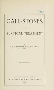 Cover of: Gall-stones and their surgical treatment by Moynihan, Berkeley Moynihan Baron