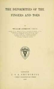 Cover of: The deformities of the fingers and toes