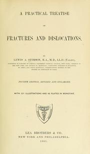 Cover of: A practical treatise on fractures and dislocations by Lewis Atterbury Stimson