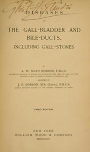 Cover of: Diseases of the gall-bladder and bile-ducts: including gall-stones