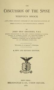 Cover of: On concussion of the spine by John Eric Erichsen