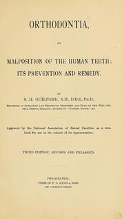 Cover of: Orthodontia, or malposition of the human teeth | Simeon Hayden Guilford