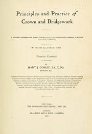 Principles and practice of crown and bridgework