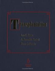 Cover of: Transplantation