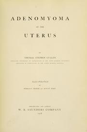 Cover of: Adenomyoma of the uterus