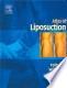 Cover of: Atlas of liposuction