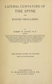 Cover of: Lateral curvature of the spine and round shoulders