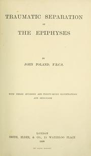 Traumatic separation of the epiphyses by Poland, John