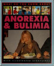 Cover of: Anorexia & bulimia
