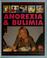 Cover of: Anorexia & bulimia
