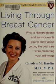 Cover of: Living through breast cancer: what a Harvard doctor and survivor wants you to know about getting the best care while preserving your self-image