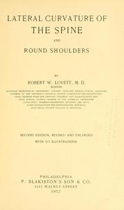 Cover of: Lateral curvature of the spine and round shoulders