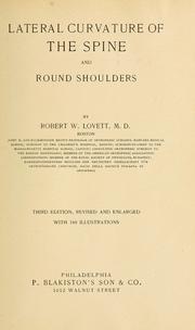 Cover of: Lateral curvature of the spine and round shoulders by Robert W. Lovett, Robert W. Lovett