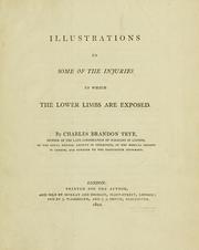Cover of: Illustrations of some of the injuries to which the lower limbs are exposed by Charles Brandon Trye