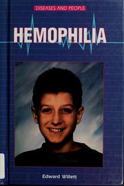 Cover of: Hemophilia