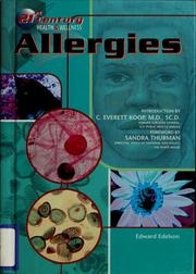 Cover of: Allergies by Edward Edelson