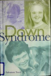 Cover of: Down syndrome