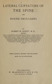 Cover of: Lateral curvature of the spine and round shoulders