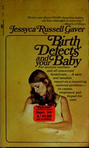 Cover of: Birth defects and your baby