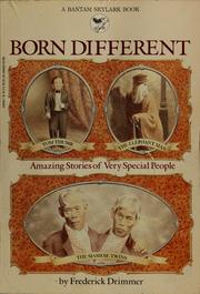 Cover of: Born different: amazing stories of very special people