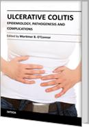 Ulcerative Colitis - Epidemiology, Pathogenesis and Complications by Mortimer B. O'Connor