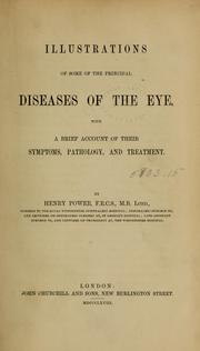 Cover of: Illustrations of some of the principal diseases of the eye: with a brief account of their symptoms, pathology, and treatment