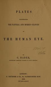 Cover of: Plates illustrating the natural and morbid changes of the human eye