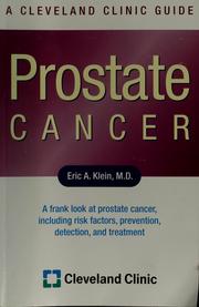 Cover of: Prostate cancer: a Cleveland Clinic guide