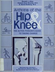 Cover of: Arthritis of the hip and knee by Allen, Ronald J.