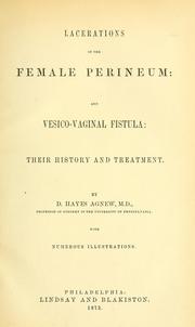 Cover of: Lacerations of the female perineum: and vesico-vaginal fistula : their history and treatment