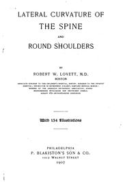 Cover of: Lateral curvature of the spine and round shoulders by Robert Williamson Lovett, Robert Williamson Lovett