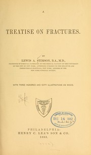 Cover of: A treatise on fractures. by Lewis Atterbury Stimson