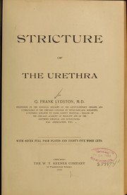 Cover of: Stricture of the urethra