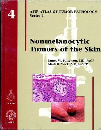 Nonmelanocytic Tumors of the Skin (Atlas of Tumor Pathology Series IV