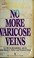 Cover of: No More Varicose Veins