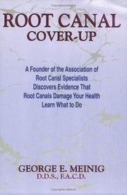 Cover of: Root canal cover-up