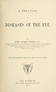 Cover of: A treatise on diseases of the eye by John Elmer Weeks